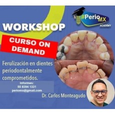 Ferulizacion en dientes periodontales comprometidos